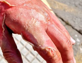 Cómo prevenir incendios en la cocina