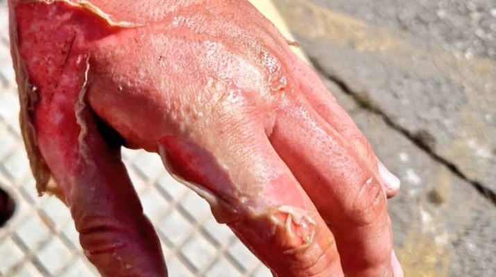 Cómo prevenir incendios en la cocina